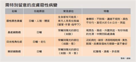 皮膚癌|皮膚癌分期治療方式？皮膚癌照片、治療費用、治癒率一次看